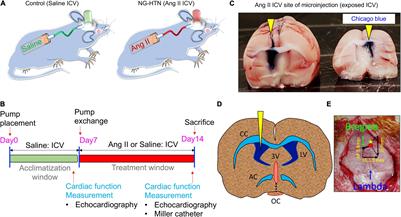 Neurogenic Hypertension Mediated Mitochondrial Abnormality Leads to Cardiomyopathy: Contribution of UPRmt and Norepinephrine-miR- 18a-5p-HIF-1α Axis